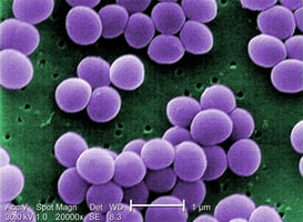 Staphylococcus_aureus_VISA_2